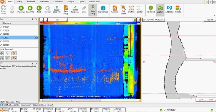 IRIS Ultrasound